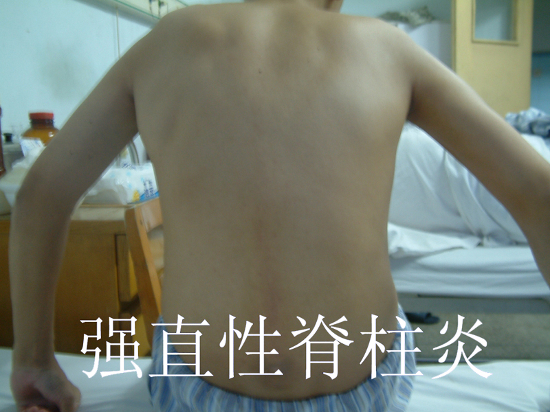 上海强直医院